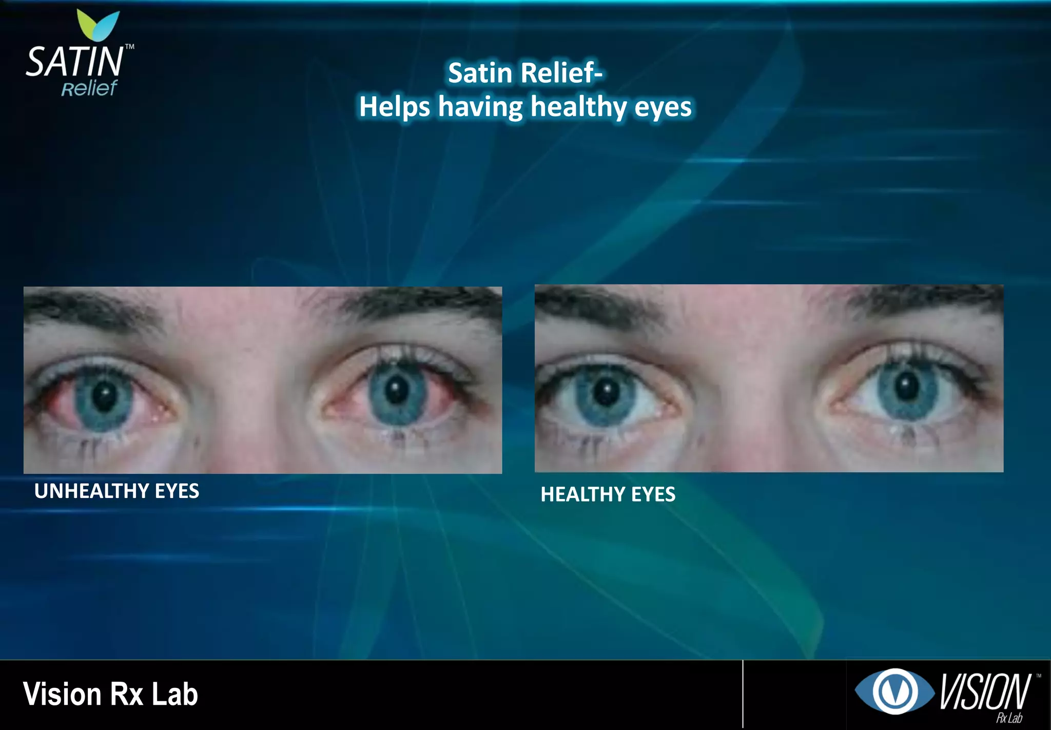 UNHEALTHY EYES
Satin Relief-
Helps having healthy eyes
HEALTHY EYES
Vision Rx Lab
 
