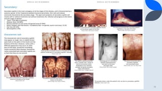 PRESENTATION TITLE 13
 