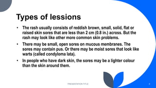 PRESENTATION TITLE 9
Types of lessions
• The rash usually consists of reddish brown, small, solid, flat or
raised skin sores that are less than 2 cm (0.8 in.) across. But the
rash may look like other more common skin problems.
• There may be small, open sores on mucous membranes. The
sores may contain pus. Or there may be moist sores that look like
warts (called condyloma lata).
• In people who have dark skin, the sores may be a lighter colour
than the skin around them.
 