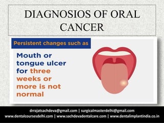 DIAGNOSIOS OF ORAL
CANCER
 