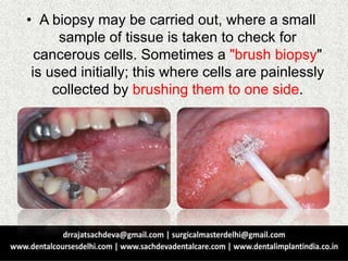 • A biopsy may be carried out, where a small
sample of tissue is taken to check for
cancerous cells. Sometimes a "brush biopsy"
is used initially; this where cells are painlessly
collected by brushing them to one side.
 