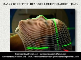 MASKS TO KEEP THE HEAD STILL DURING RADIOTHERAPY
 