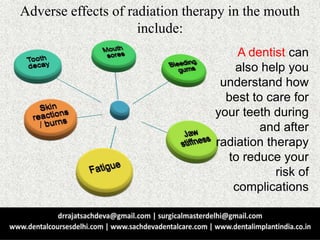 Adverse effects of radiation therapy in the mouth
include:
A dentist can
also help you
understand how
best to care for
your teeth during
and after
radiation therapy
to reduce your
risk of
complications
 