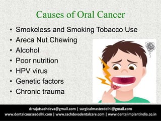 Causes of Oral Cancer
• Smokeless and Smoking Tobacco Use
• Areca Nut Chewing
• Alcohol
• Poor nutrition
• HPV virus
• Genetic factors
• Chronic trauma
 