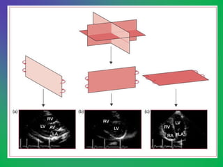 ECHOCARDIOGRAM | PPT