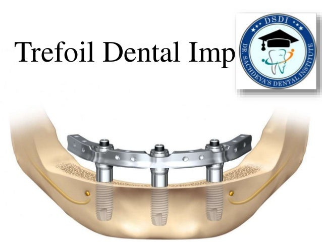 Trefoil Dental Implant From Nobel Biocare Trefoil A New Solution F