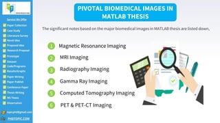 Biomedical Thesis in Matlab | PPTX
