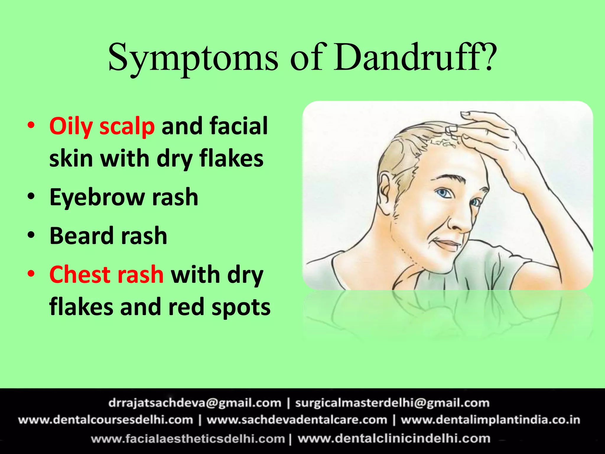 Dandruff| How to get rid of Tooth Trauma| Seborrhiec Dermatitis ...