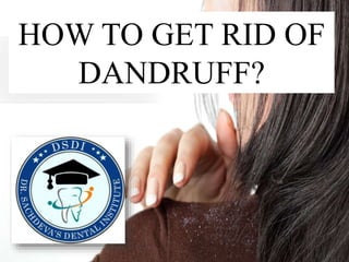 HOW TO GET RID OF
DANDRUFF?
 