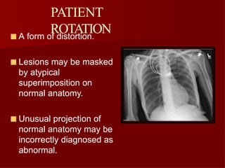 Comprehensive Overview of Radiographic Artifacts in Medical Imaging | PPTX