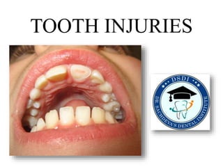 TOOTH INJURIES
 