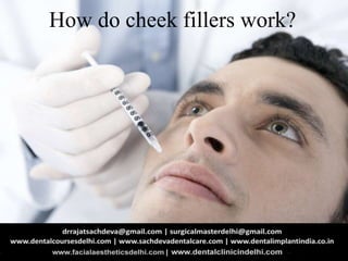 How do cheek fillers work?
 