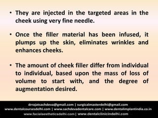 • They are injected in the targeted areas in the
cheek using very fine needle.
• Once the filler material has been infused, it
plumps up the skin, eliminates wrinkles and
enhances cheeks.
• The amount of cheek filler differ from individual
to individual, based upon the mass of loss of
volume to start with, and the degree of
augmentation desired.
 