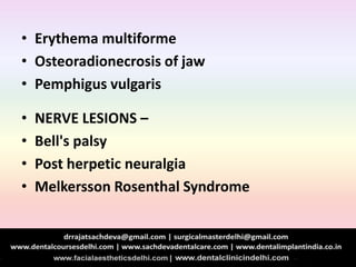 • Erythema multiforme
• Osteoradionecrosis of jaw
• Pemphigus vulgaris
• NERVE LESIONS –
• Bell's palsy
• Post herpetic neuralgia
• Melkersson Rosenthal Syndrome
 