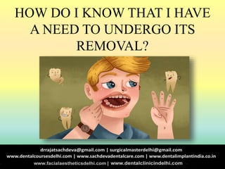 HOW DO I KNOW THAT I HAVE
A NEED TO UNDERGO ITS
REMOVAL?
 
