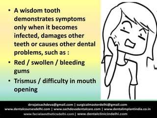 • A wisdom tooth
demonstrates symptoms
only when it becomes
infected, damages other
teeth or causes other dental
problems, such as :
• Red / swollen / bleeding
gums
• Trismus / difficulty in mouth
opening
 