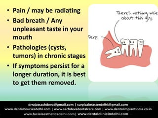 • Pain / may be radiating
• Bad breath / Any
unpleasant taste in your
mouth
• Pathologies (cysts,
tumors) in chronic stages
• If symptoms persist for a
longer duration, it is best
to get them removed.
 