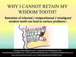 WHY I CANNOT RETAIN MY
WISDOM TOOTH?
Retention of infected / malpositioned / misaligned
wisdom tooth can lead to various problems :
 