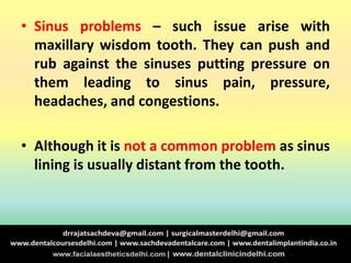 • Sinus problems – such issue arise with
maxillary wisdom tooth. They can push and
rub against the sinuses putting pressure on
them leading to sinus pain, pressure,
headaches, and congestions.
• Although it is not a common problem as sinus
lining is usually distant from the tooth.
 