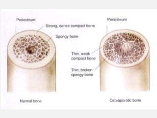 Parallel Medium Bone ppt 3 Diagnostic Imaging of Bones and Joints.pptx