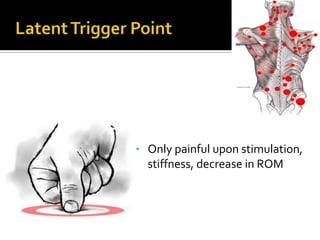 • Only painful upon stimulation,
stiffness, decrease in ROM
 