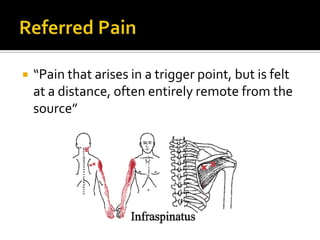  “Pain that arises in a trigger point, but is felt
at a distance, often entirely remote from the
source”
 