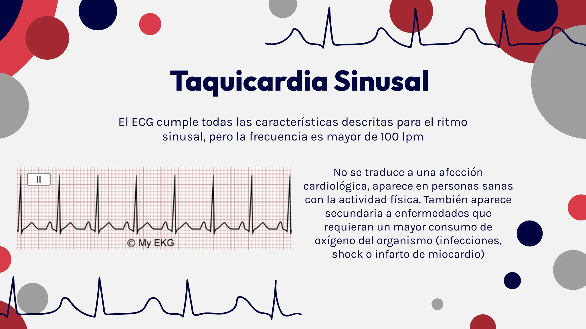 Exámen Complementario: Electrocargiograma Normal y Anormal (ECG/EKG) | PDF