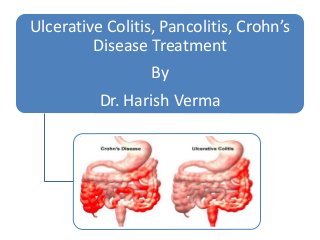 Ulcerative Colitis, Pancolitis, Crohn’s
Disease Treatment
By
Dr. Harish Verma
 