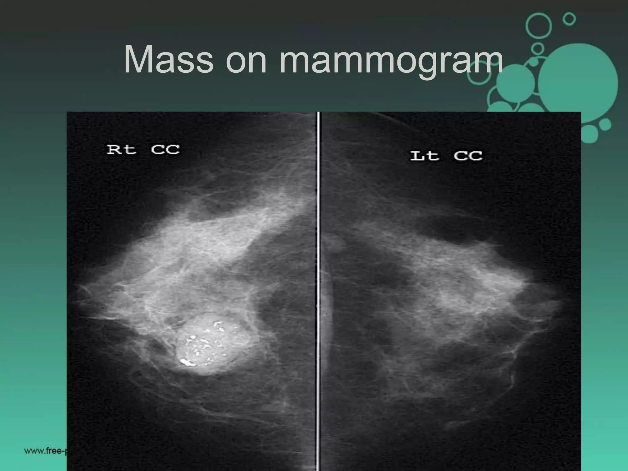 Mammogram Slides Mammography.pptx