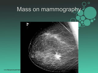 Mammogram Slides Mammography.pptx
