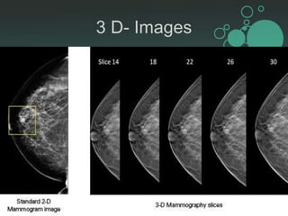 Mammogram Slides Mammography.pptx