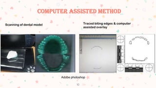 Bite mark analysis | PPTX