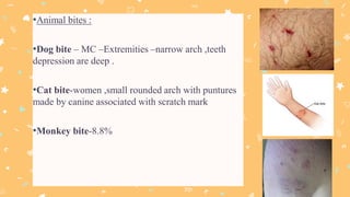 Bite mark analysis | PPTX