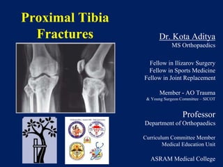 Proximal Tibia
Fractures Dr. Kota Aditya
MS Orthopaedics
Fellow in Ilizarov Surgery
Fellow in Sports Medicine
Fellow in Joint Replacement
Member - AO Trauma
& Young Surgeon Committee – SICOT
Professor
Department of Orthopaedics
Curriculum Committee Member
Medical Education Unit
ASRAM Medical College
 
