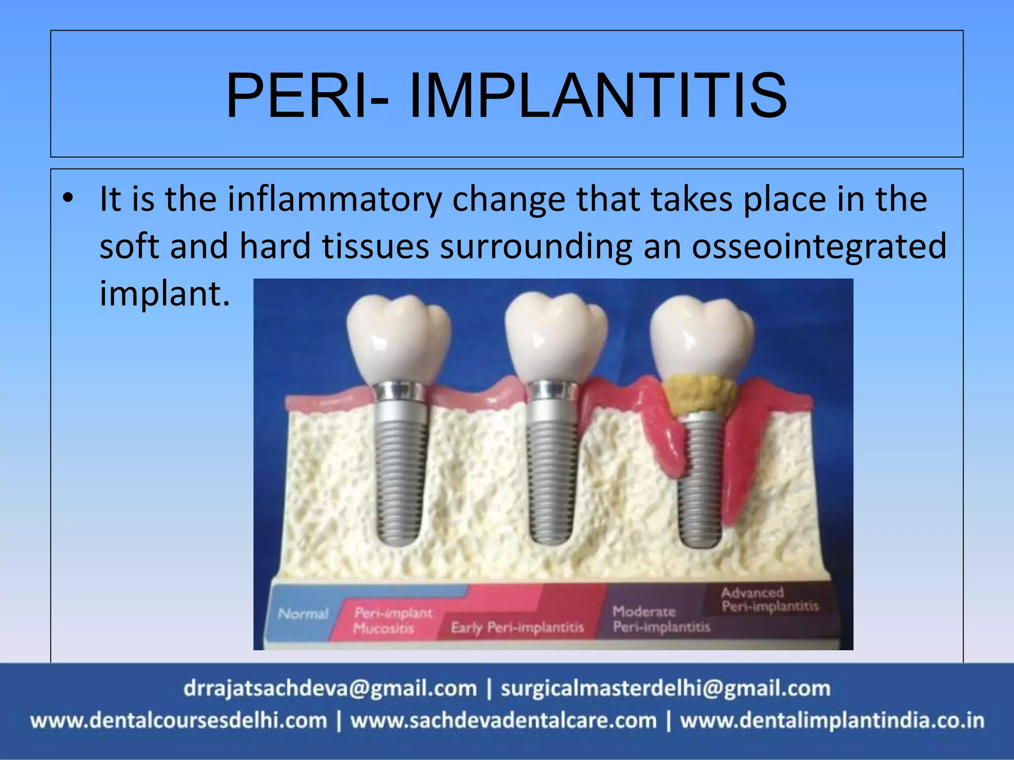 PERI- IMPLANTITIS
• It is the inflammatory change that takes place in the
soft and hard tissues surrounding an osseointegrated
implant.
 