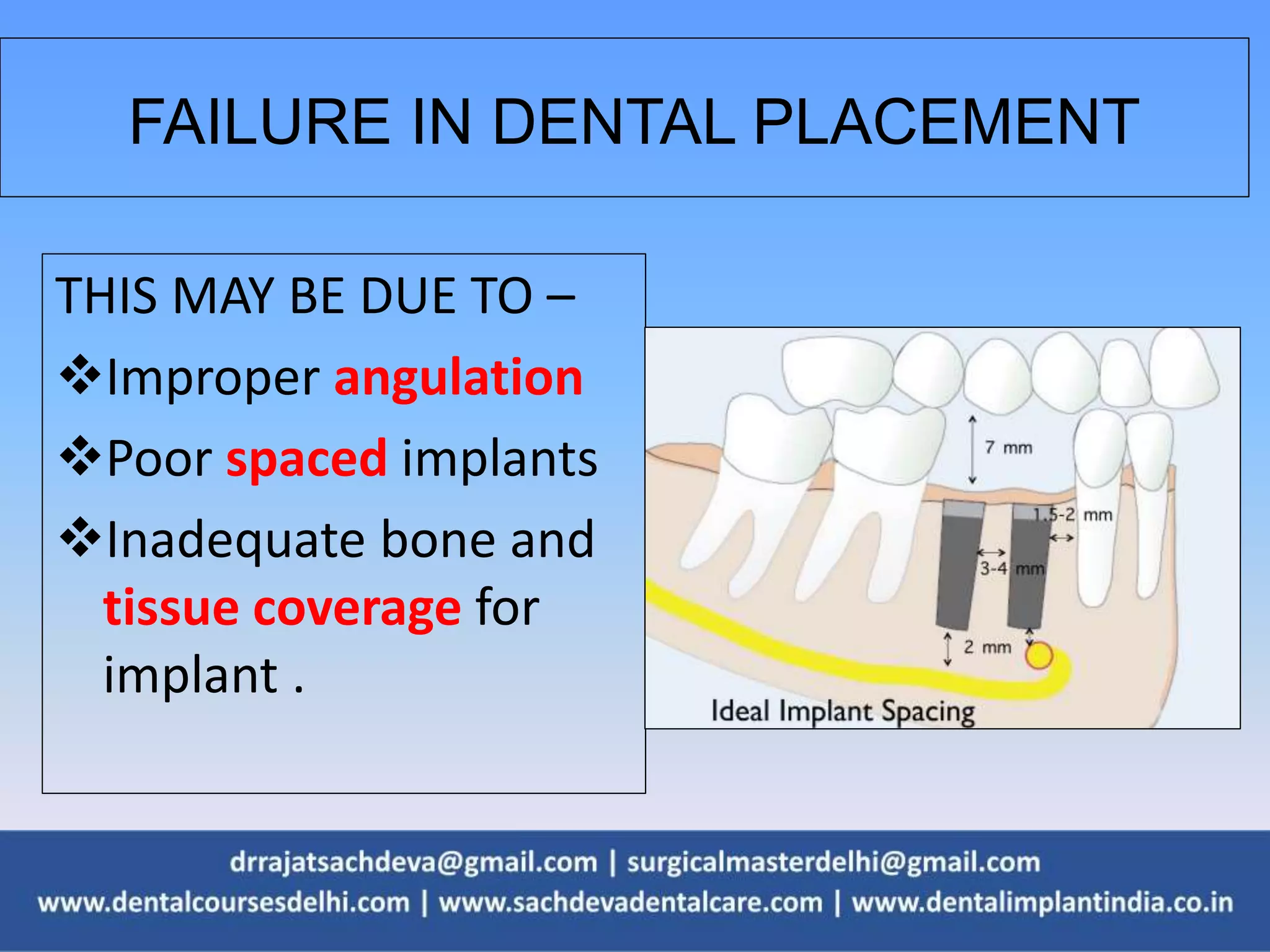 FAILURE IN DENTAL PLACEMENT
THIS MAY BE DUE TO –
Improper angulation
Poor spaced implants
Inadequate bone and
tissue coverage for
implant .
 