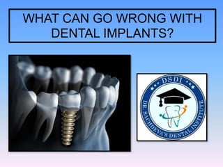 WHAT CAN GO WRONG WITH
DENTAL IMPLANTS?
 