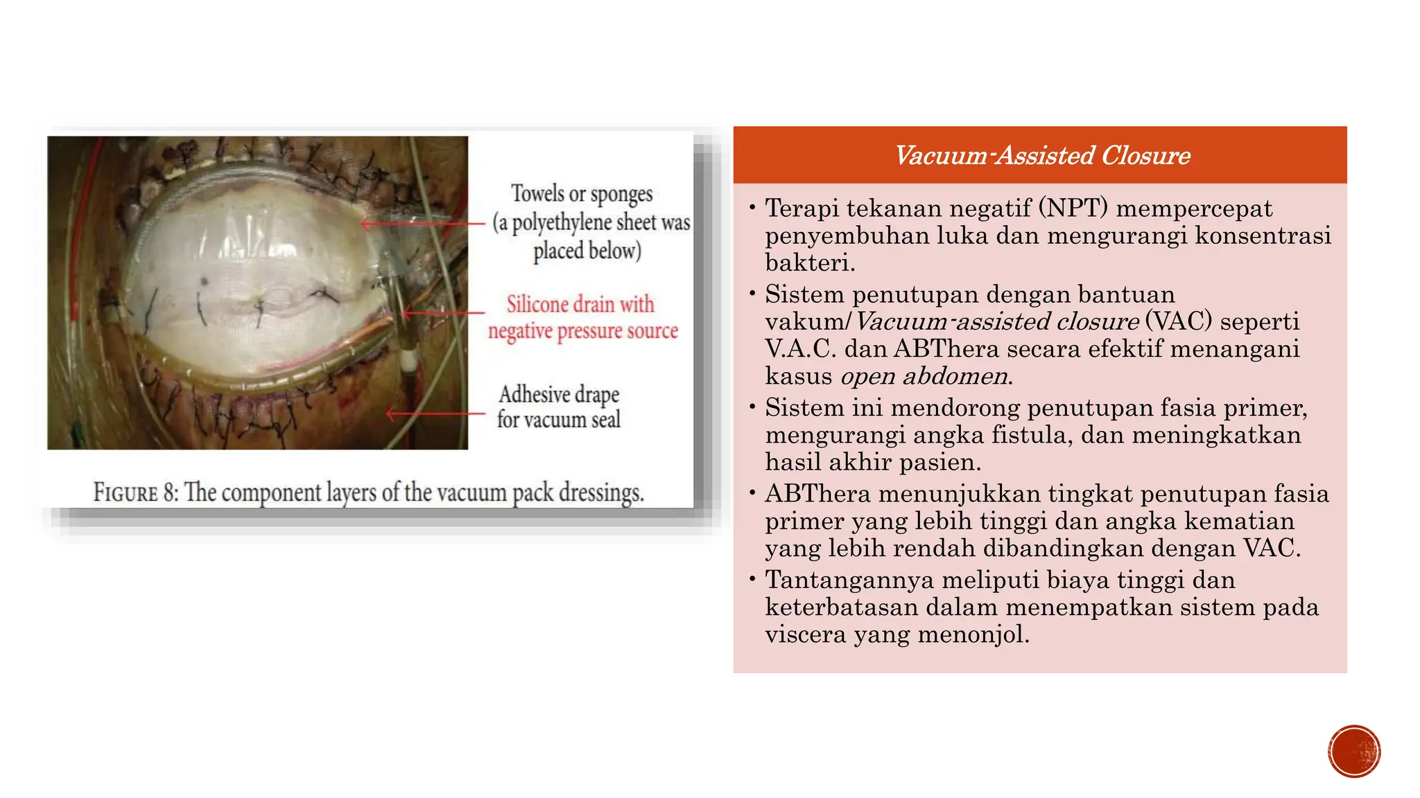 ppt abdominal wall closure indo fix oke.pptx