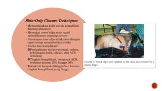 ppt abdominal wall closure indo fix oke.pptx