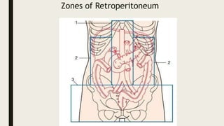 Zones of Retroperitoneum
 