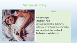 Victims of dowry
Sakina
While talking to
THE DAILY News
correspondent she told that she was
victimized by her husband, mother in law
and one sisters in law who burnt
her because of lack of dowry.
 