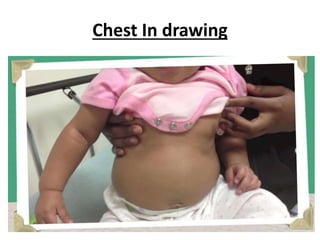 Chest In drawing
 