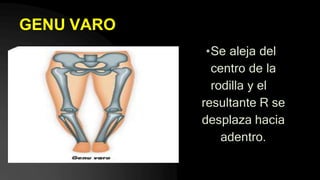 GENU VARO
•Se aleja del
centro de la
rodilla y el
resultante R se
desplaza hacia
adentro.
 