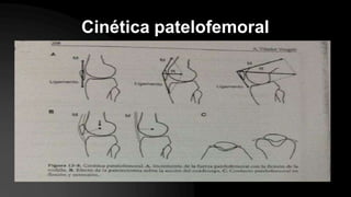 Cinética patelofemoral
 