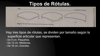 Tipos de Rótulas.
Hay tres tipos de rótulas, se dividen por tamaño según la
superficie articular que representan.
- De 9 cm. Pequeñas.
- De 12 cm. Medianas.
- De 16 cm. Grandes.
 