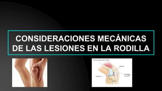 CONSIDERACIONES MECÁNICAS
DE LAS LESIONES EN LA RODILLA
 