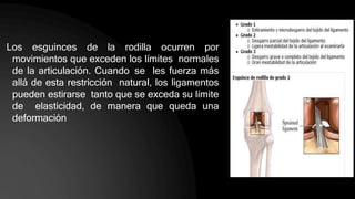 Los esguinces de la rodilla ocurren por
movimientos que exceden los límites normales
de la articulación. Cuando se les fuerza más
allá de esta restricción natural, los ligamentos
pueden estirarse tanto que se exceda su límite
de elasticidad, de manera que queda una
deformación
 