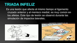 TRIADA INFELIZ
Es una lesión que afecta al mismo tiempo al ligamento
cruzado anterior y al menisco medial, es muy común en
los atletas. Este tipo de lesión se observó durante las
simulación de impactos laterales.
 