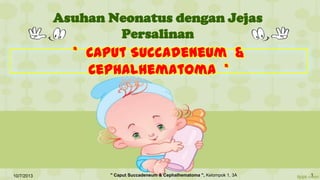 Asuhan Neonatus dengan Jejas
Persalinan
* Caput Succadeneum &
Cephalhematoma *
10/7/2013 1" Caput Succadeneum & Cephalhematoma ", Kelompok 1, 3A
 