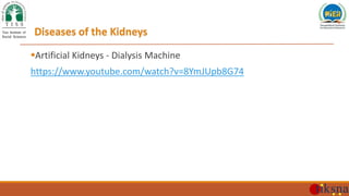 Diseases of the Kidneys
Artificial Kidneys - Dialysis Machine
https://www.youtube.com/watch?v=8YmJUpb8G74
 